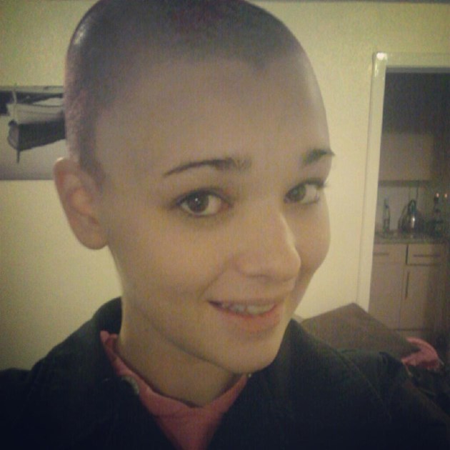 Hannah Pagdin is fundraising for Alopecia UK