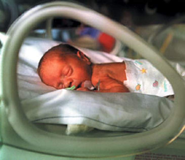 Раньше времени родилась. Недоношенный новорожденный. Самый недоношенный ребенок. У недоношенного ребенка отмечается. Новорожденные с экстремально низкой массой тела.