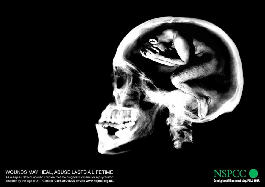 artemis-a-is-fundraising-for-nspcc