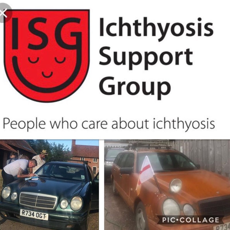 Ichthyosis Support Group