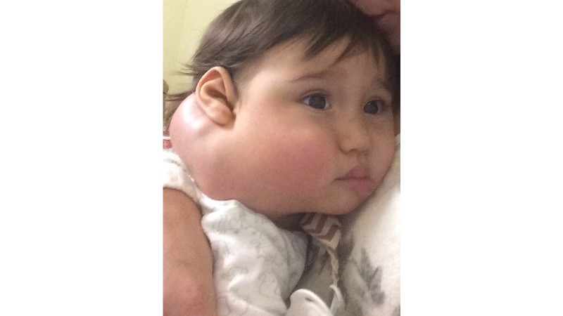 Help raise £53000 to Pay for treatment for Zayn. He has a rare and aggressive form of cancer called rhabdomyosarcoma.