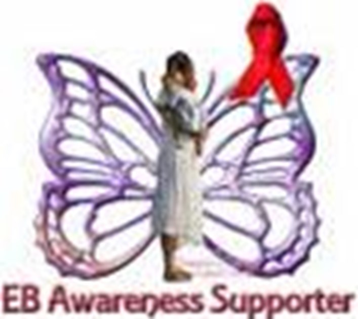 Rebecca Shedden is fundraising for DEBRA