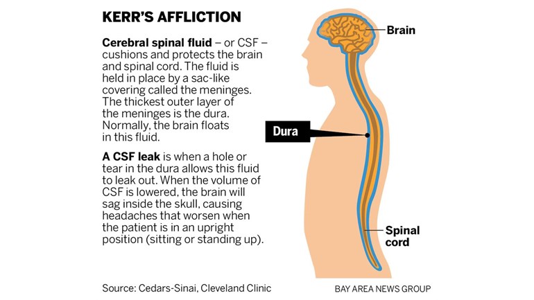 Brain Spine Foundation Adjusting To A Diagnosis Of