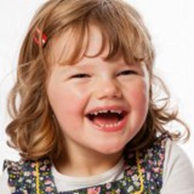 a study of angelman syndrome Angelman syndrome is a genetic condition that is present at birth (congenital) it causes intellectual disability and other features other characteristics of angelman syndrome include distinctive facial features, mental retardation, speech problems and hyperactive behaviour. a study of angelman syndrome Angelman syndrome is a genetic condition that is present at birth (congenital) it causes intellectual disability and other features other characteristics of angelman syndrome include distinctive facial features, mental retardation, speech problems and hyperactive behaviour.
