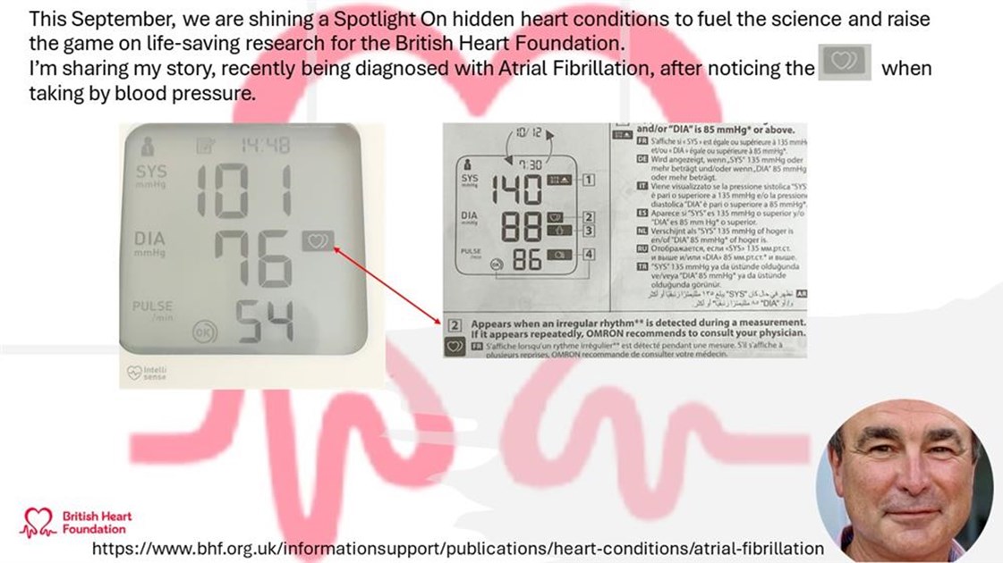 Do I need to do 24-hour blood pressure monitoring? - BHF