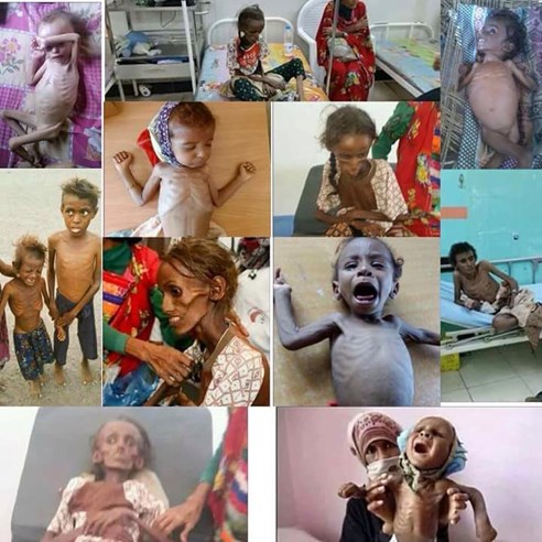 Image result for Yemen Crisis