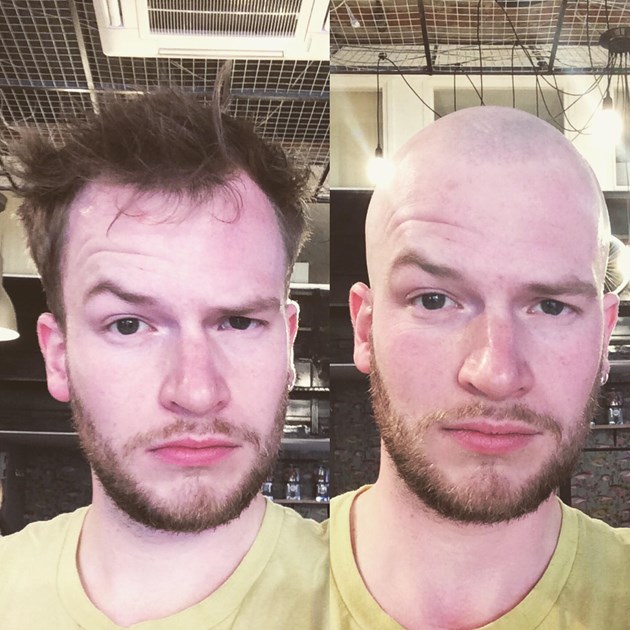 Exclusive:  The Untold Truth About Meredith'S Head Shave - wiyzl4j